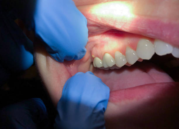 Best Dentist for Severe Toothache  in Mckenzie, TN